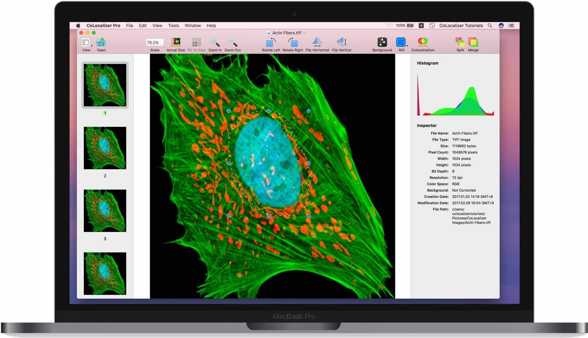 CoLocalizer Pro 7.0.2 (982) 定量共定位分析软件 CoLocalizer Pro 7.0.2 (982) 定量共定位分析软件