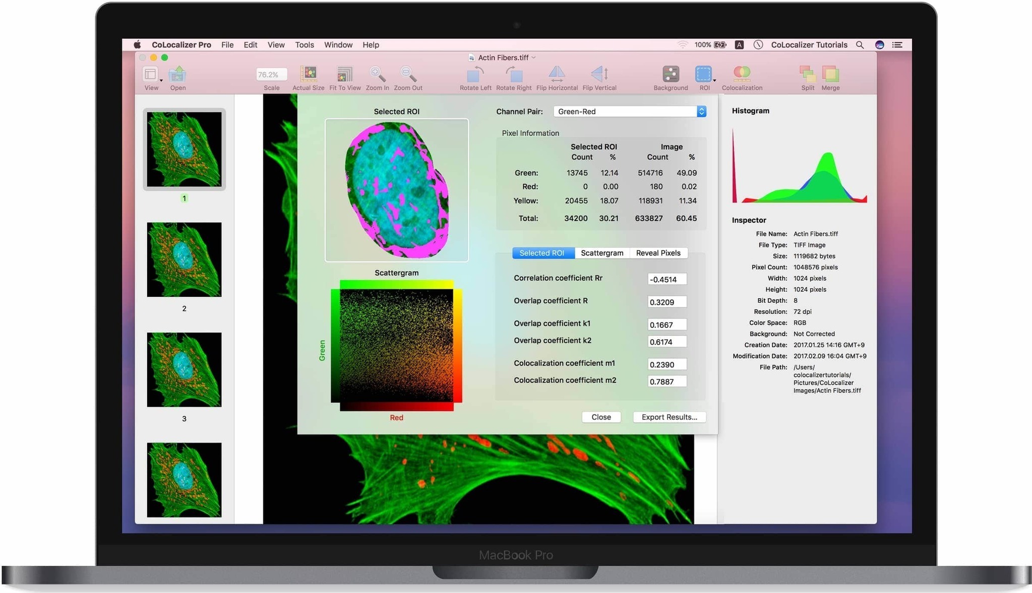 CoLocalizer Pro 7.0.2 (982) 定量共定位分析软件 CoLocalizer Pro 7.0.2 (982) 定量共定位分析软件