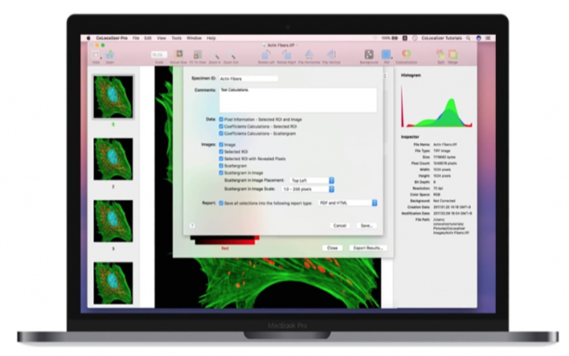 CoLocalizer Pro 7.0.2 for Mac|Mac版下载 | 图像分析工具