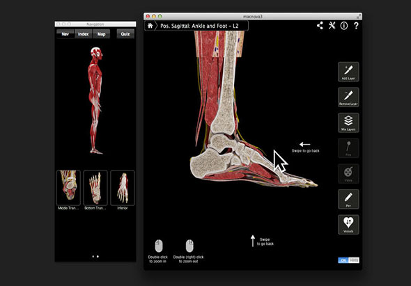 Ankle & Foot Pro III 3.8 for Mac|Mac版下载 | 