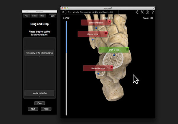 Ankle & Foot Pro III 3.8 for Mac|Mac版下载 | 