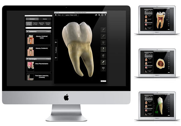 Dental Patient Education 1.1 for Mac|Mac版下载 |