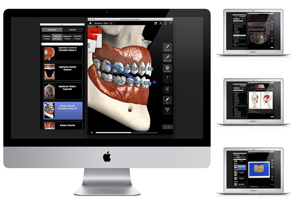 Dental Patient Education 1.1 for Mac|Mac版下载 |