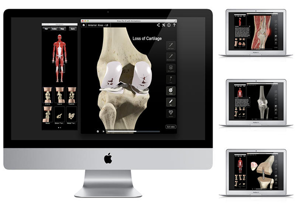Knee Pro III with Animations 3.8 for Mac|Mac版下载 |