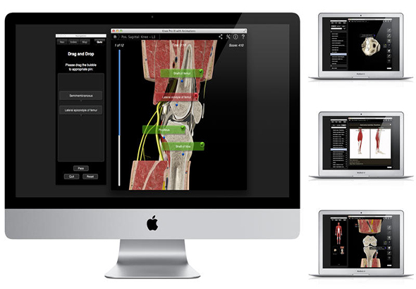 Knee Pro III with Animations 3.8 for Mac|Mac版下载 |