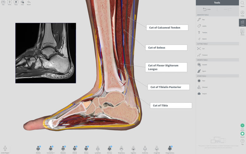 Complete Anatomy 2018 for Mac 3.3 破解版 - 强大的3D医学人体模型
