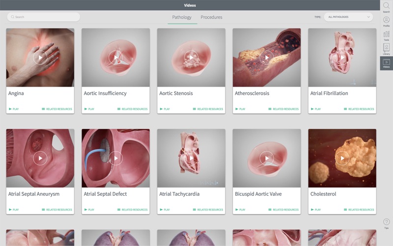 Complete Heart for Mac 1.1 破解版 - 3D心脏医学参考模型